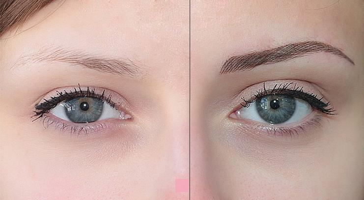 Correction tatouage sourcils