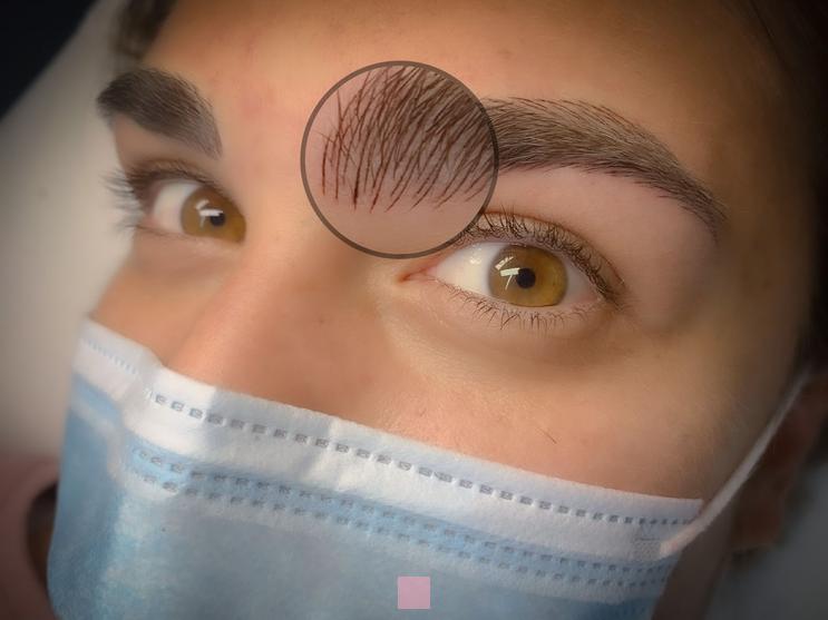 Évolution cicatrisation microblading