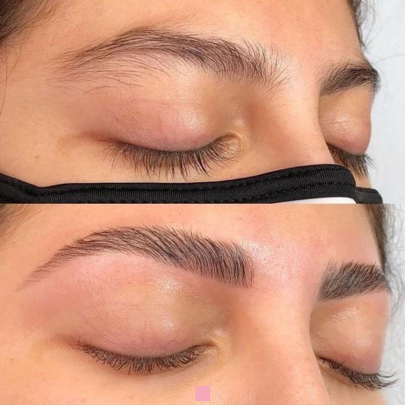 Rehaussement de sourcils tarif