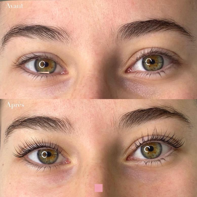 Rehaussement de sourcils tarif