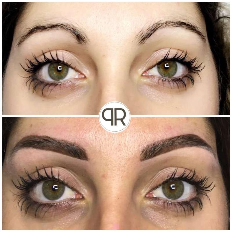 Restructuration des sourcils