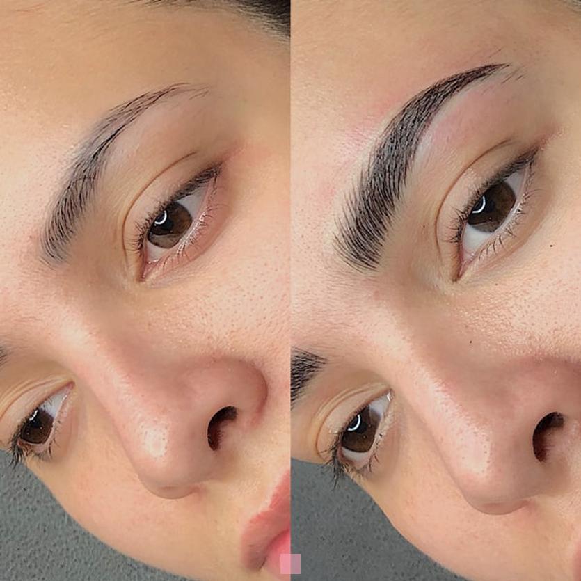 Restructuration des sourcils