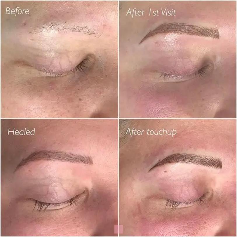 Symptômes d'infection après microblading